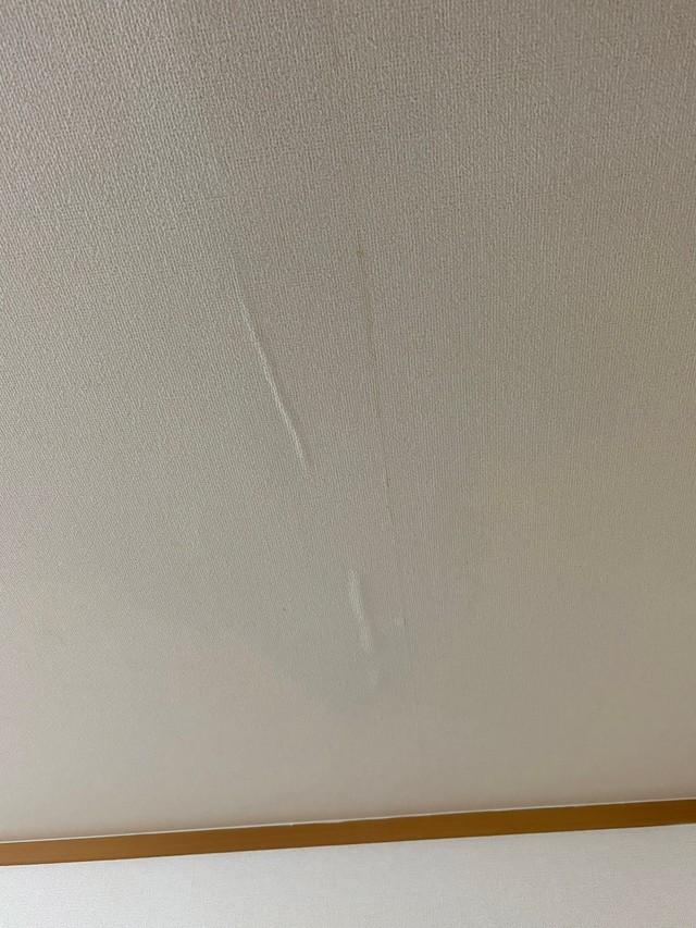 翌朝はふくらみがおさまっていたものの…（独身くそおばさん提供）