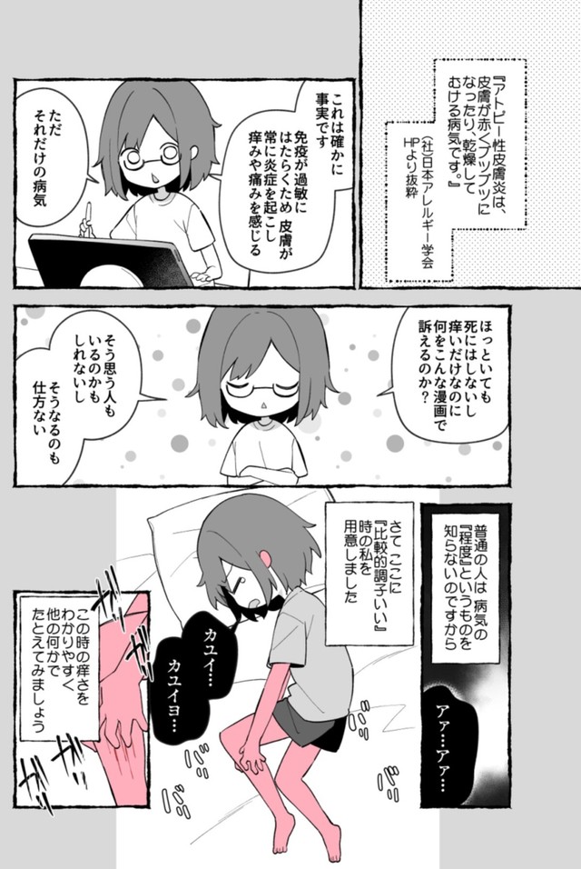 【漫画】『最重度のアトピーだった私が、人権を金で買った話』2（ユイザキカズヤさん提供）