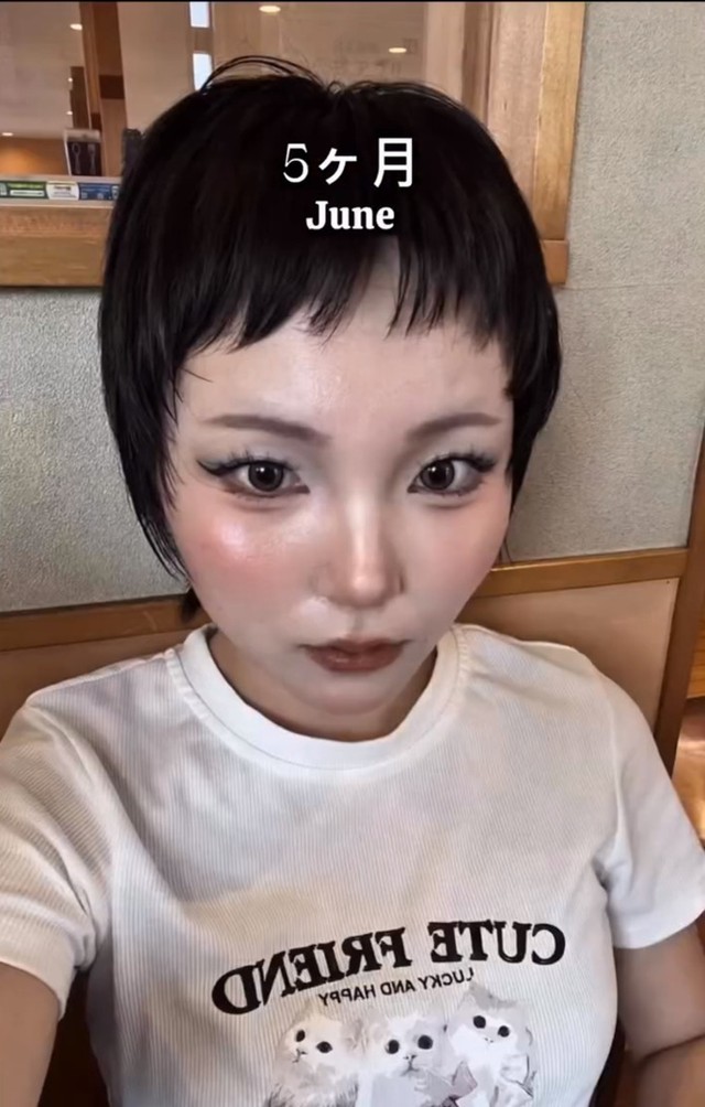 5カ月後（6月）のHANAさん。前髪が整ってきたころ／HANAさん（_hana8787_）提供