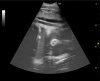 「分かりやすいゾウの形を初めて捉えた」と紹介された画像。どう見ても「鼻」です（2025.2.5 安佐動物公園提供）