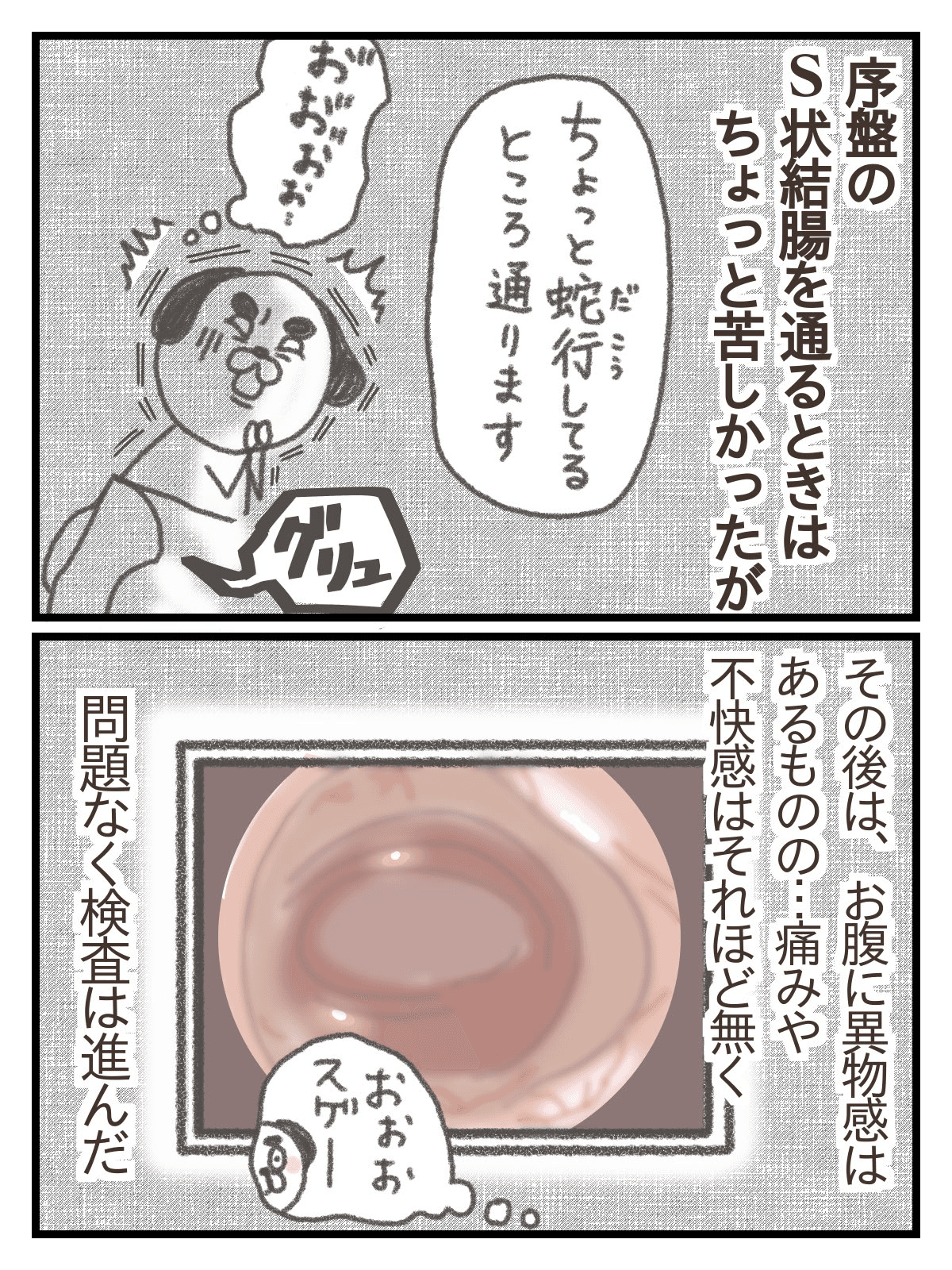【漫画】『下血して内視鏡検査する話』22（きさらぎさん提供）