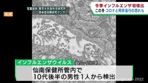 インフルエンザウイルス　宮城県で今シーズン初めて検出　専門家「インフル抗体が落ちている」秋冬にコロナと同時流行の可能性を指摘
