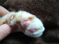 治療や自宅でのケアでその後、爪はきれいに