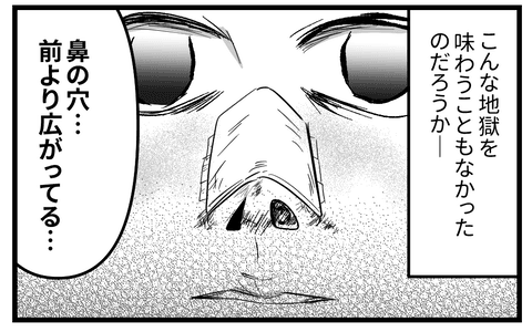 修正も失敗。以前よりコンプレックスが増えることに（うみの韻花さん提供）