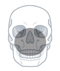 「形成外科が関わる顔面外傷の中でも最悪の類」と言われる「熊外傷」。最も多いのがグレー部分「中顔面」の損傷なのだそう。