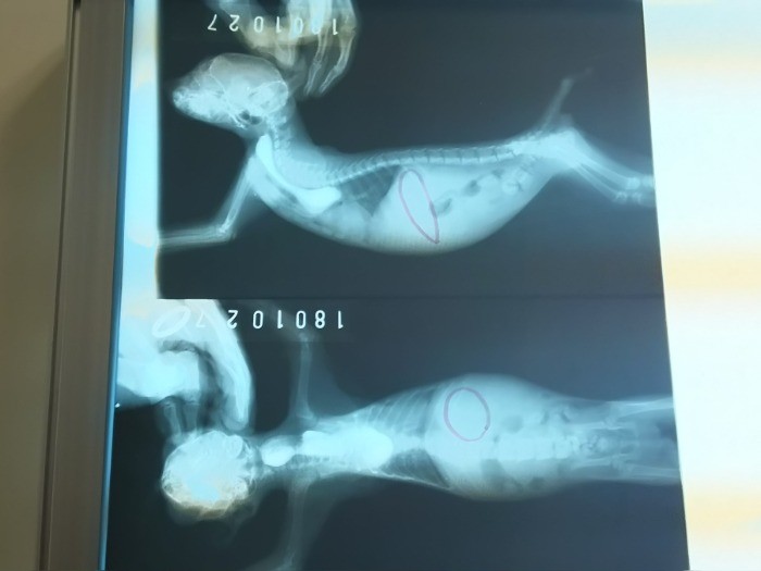 横から撮影したものと、あおむけに撮影したレントゲン写真。赤い丸がついている部分が胃。途中までバリウムが映っているのに、胃の少し手前で食道が詰まって、先へ進んでいないのがわかる