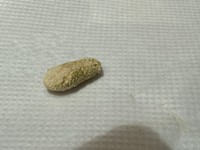 唾石の主成分はカルシウムで、細菌や異物が核となって形成されることが多いそう。