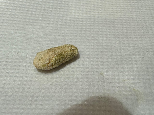 唾石の主成分はカルシウムで、細菌や異物が核となって形成されることが多いそう。