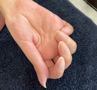 自身が動かせるのは右手の指先2本のみ