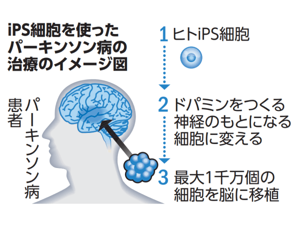 いのちをつくる ~iPS細胞・ES細胞がかなえる未来~ [DVD] いのちをつくる～iPS細胞・ES細胞がかなえる未来～ - unplugged