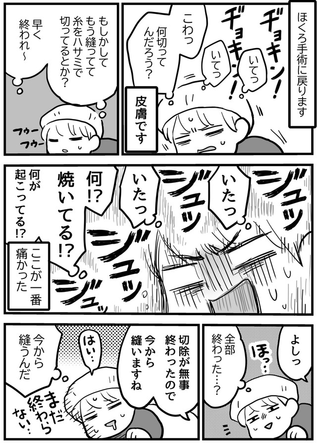 【漫画】『ほくろ切除の手術をしました』5（きくまきさん提供）
