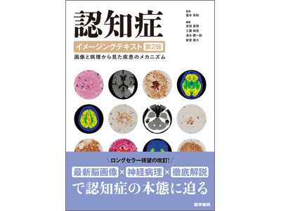 認知症の本態に迫る！書籍『認知症イメージングテキスト 第2版 ―画像と