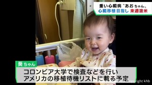 重い心臓病の１歳女児　心臓移植手術のため３０日にアメリカへ