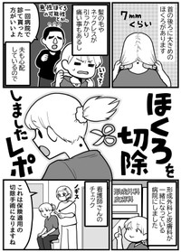 【漫画】『ほくろ切除の手術をしました』1（きくまきさん提供）