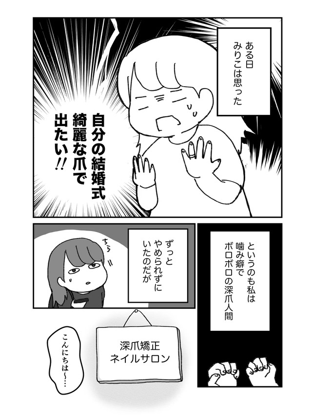 【漫画】『深爪矯正で人生変わった話』1（みりこさん提供）
