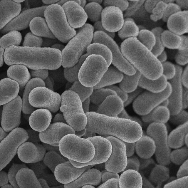体重の増加を抑える腸内細菌 日本人の腸内研究で発見 糖尿病の改善にも期待 カギは産生する物質