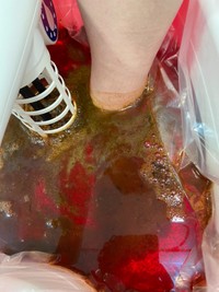 解毒機器に入れた足から排出された老廃物で湯が茶色に濁った＝東京・新橋の珍雲堂本店