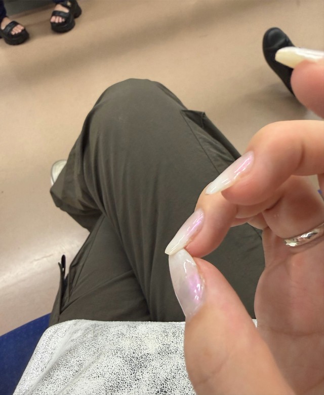 きれいに整えていた爪も折れてしまった（脱走したゴリラさん提供）