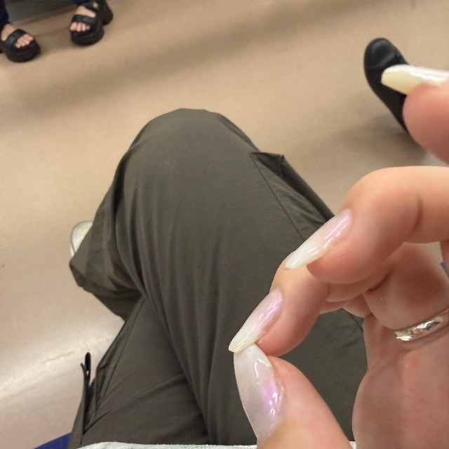 きれいに整えていた爪も折れてしまった（脱走したゴリラさん提供）