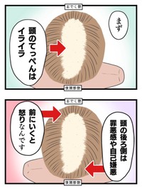 【漫画】『女だけど坊主にしました。〜13年間悩み続けた抜毛症が治るまで〜』11（春乃おはなさん提供）