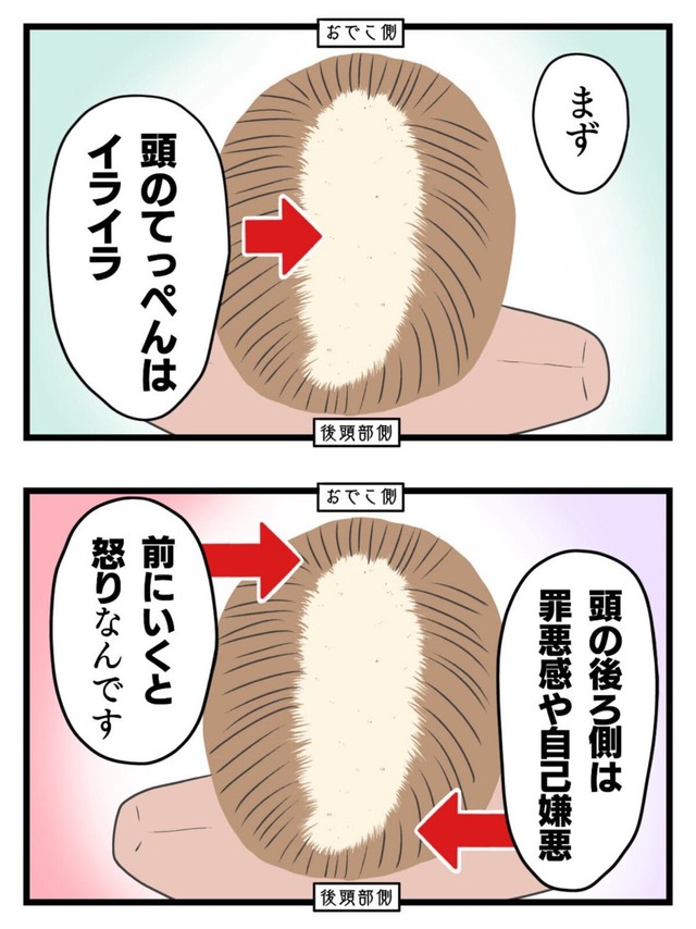 【漫画】『女だけど坊主にしました。〜13年間悩み続けた抜毛症が治るまで〜』11（春乃おはなさん提供）