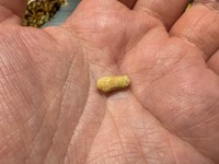 口内から出てきた唾石。