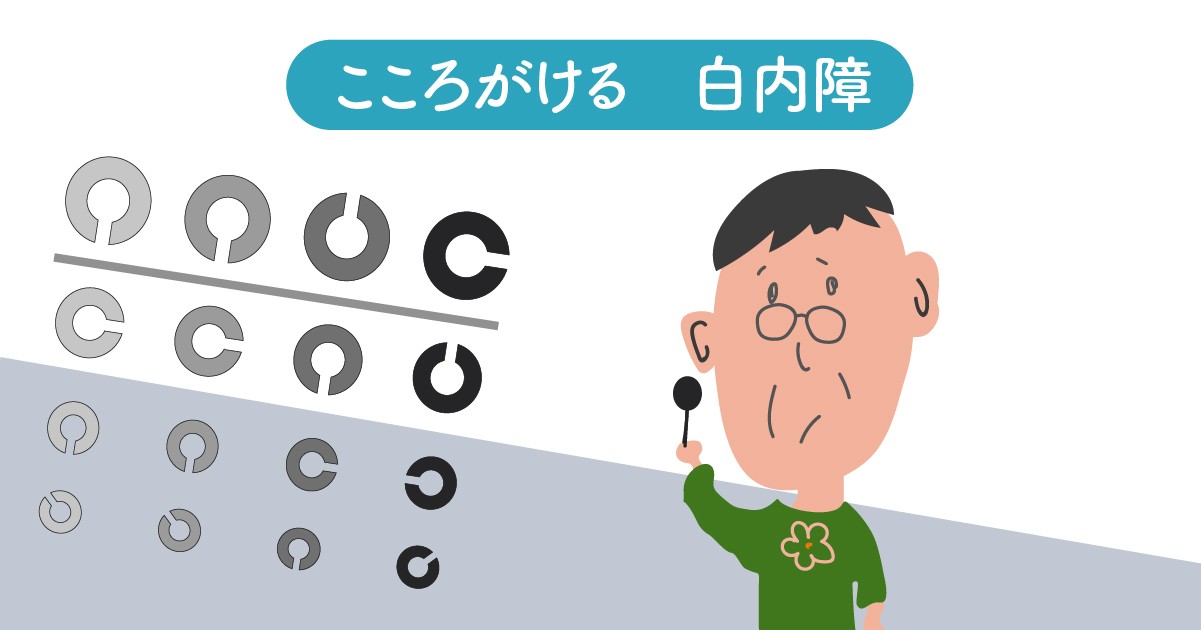 白内障と認知症の関係を専門家が徹底解説 目もアンチエイジングを なかまぁる