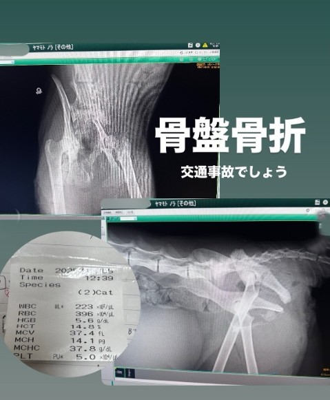 診断の結果、骨盤骨折だった（「ねころび」さん提供、Instagramよりキャプチャ撮影）