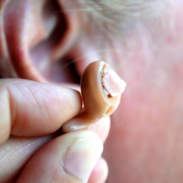 補聴器の着用、認知症予防の効果あり