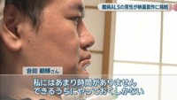 難病ALS／合田朝輝さん