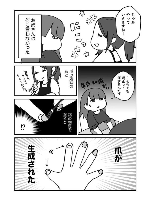 【漫画】『深爪矯正で人生変わった話』3（みりこさん提供）
