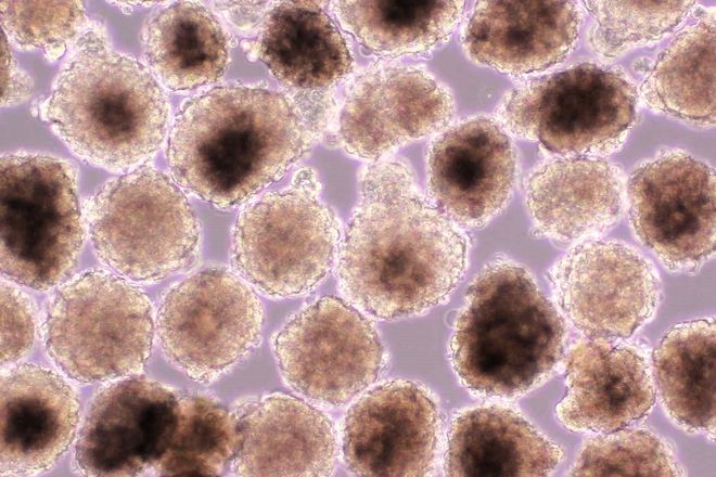 Startup: Tissue derived from iPS cells can treat heart failure