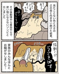 【漫画】『結婚指輪が抜けなくなった話』17（ゆう｜ノープロブレムキャットさん提供）