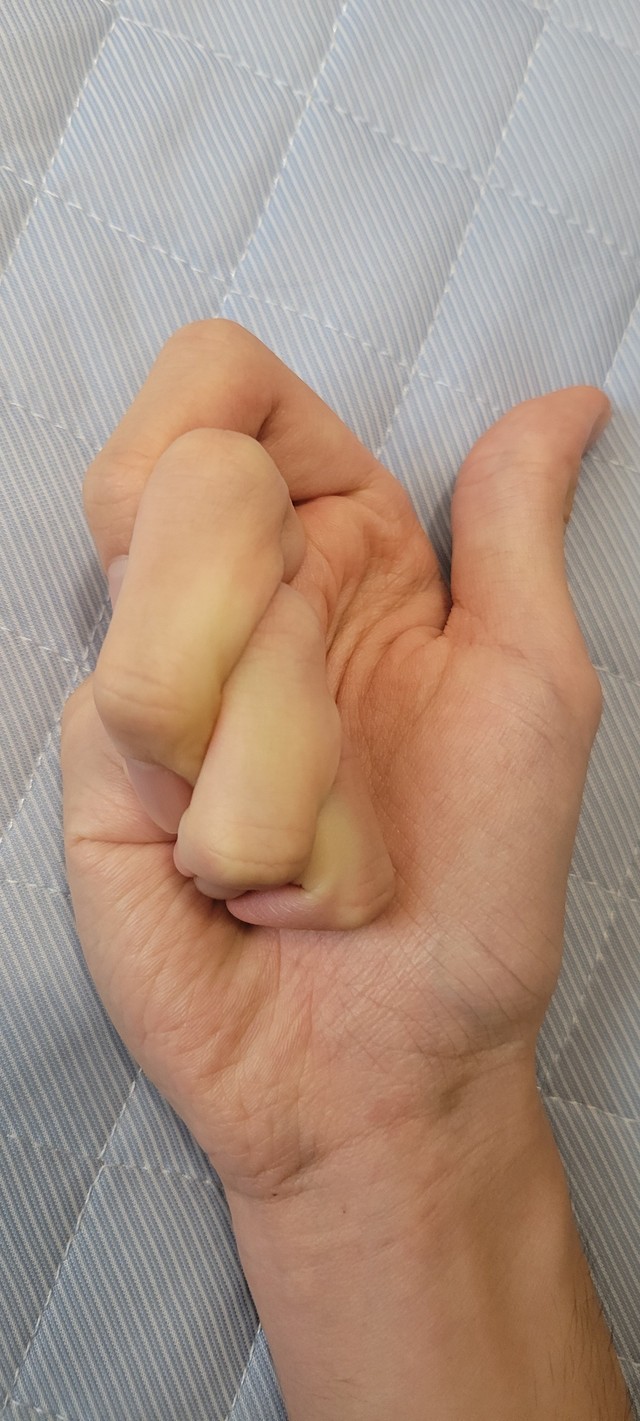 形容しがたい指の形