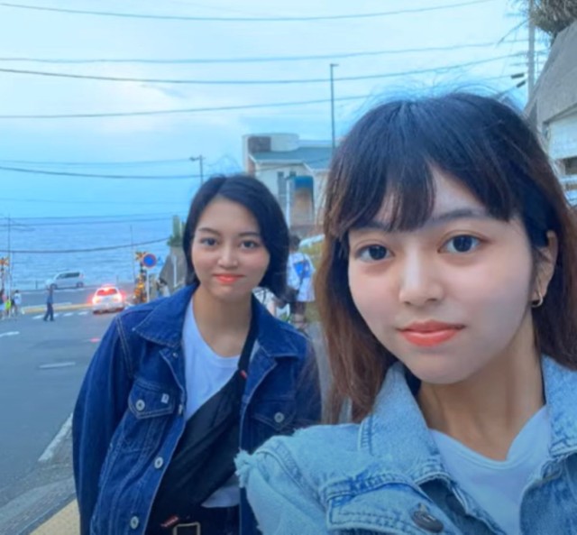 結合双生児として生まれた双子姉妹／長嶺姉妹さん（@sakahika）提供