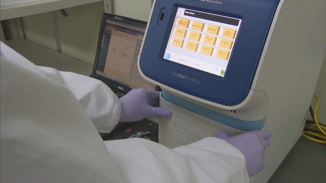 岡山県で1429人が新たに感染、4人が死亡〈新型コロナ〉