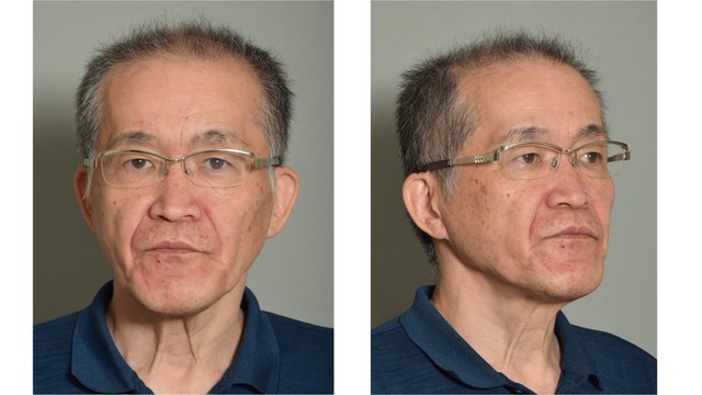 【速報】高松市の住宅で起きた強盗致傷事件　近くに住む64歳男を指名手配