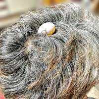 キジバトのリンちゃんが産卵した場所はーーまさかのパパの頭の上でした（画像提供：ぽぅぽぅのいる世界さん）