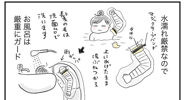 お風呂の時は腕を厳重にガード（柿ノ種まきこさん提供）
