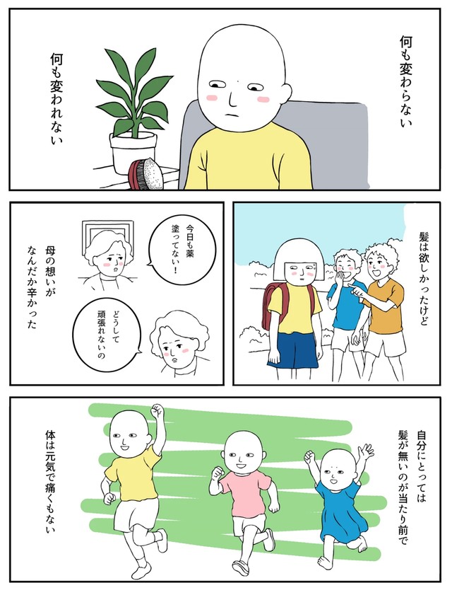 【漫画】『「髪が無かった、ただそれだけのこと」〜治したい母と治れない私〜』11（羊と狼さん提供）