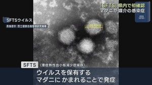 宮城県で初めて発生を確認　マダニが媒介の重症熱性血小板減少症候群ＳＦＴＳ　石巻保健所管内の９０代男性
