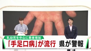 手足口病の患者数増加で宮城県が警報　新型コロナも患者数増加