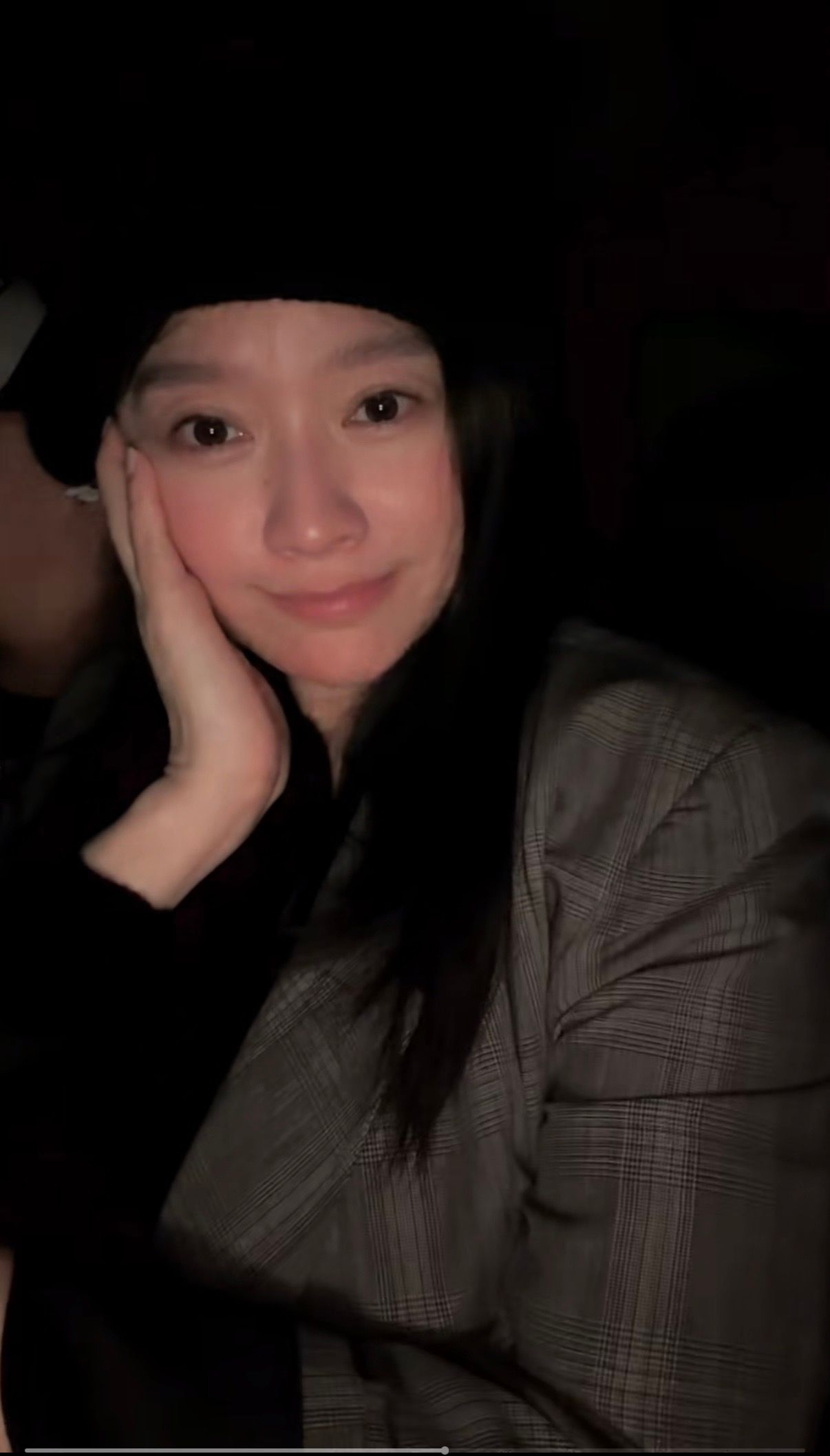 篠原 涼子 鼻