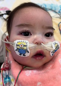 酸素チューブに貼られたかわいいシールからも愛情が伝わってくる