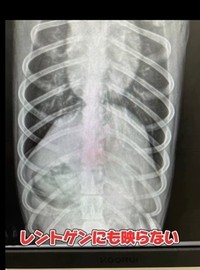 飲み込んだ竹串はレントゲンに映らないという（稲野辺院長提供、Instagramよりキャプチャ撮影）