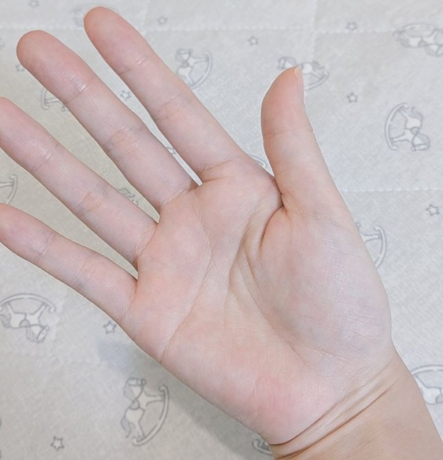 母である最中もなかさんの手 ※最中もなかさん提供