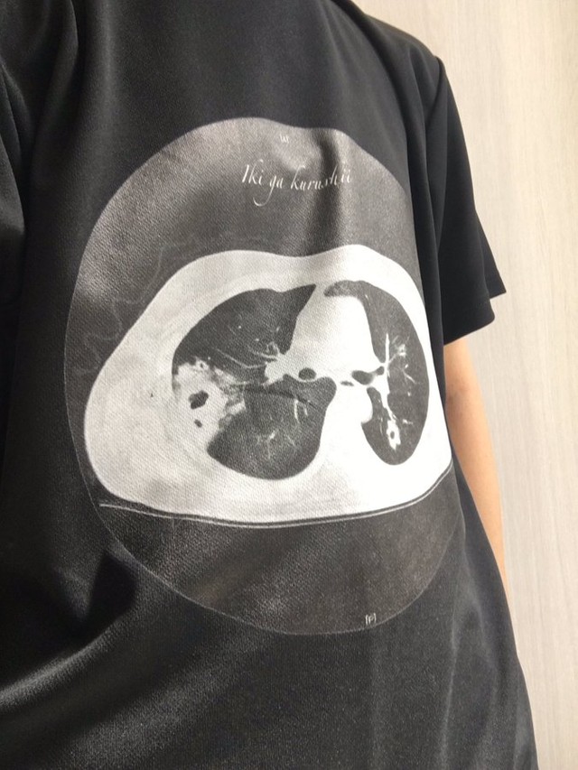 肺に大きな空洞があるけど……クールなTシャツに仕上がっています！（提供：ヨシサキネコム16gさん）