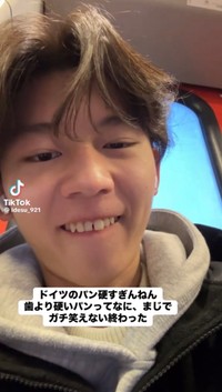 歯を出して前歯のようすを確認する依田さん／依田怜大さん（@ldesu_921）提供