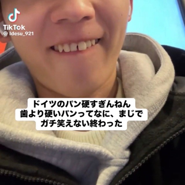 歯を出して前歯のようすを確認する依田さん／依田怜大さん（@ldesu_921）提供