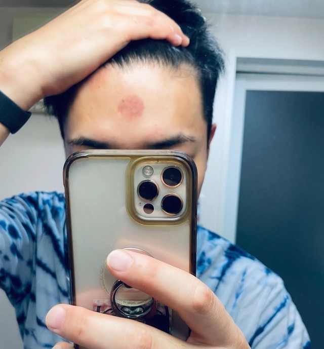 理想の人生計画とは少し違うけれど、こんなにも幸せな今。おでこのアザは、娘さんとの充実した時間を物語る、何よりの証かもしれません／Nao Kiさん（@nokkgym）提供